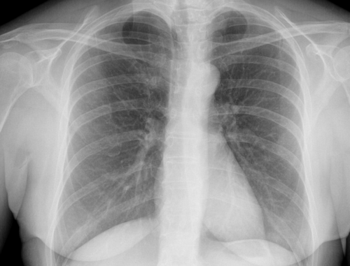 Mes données de santé-iu Conservation de mes données de santé